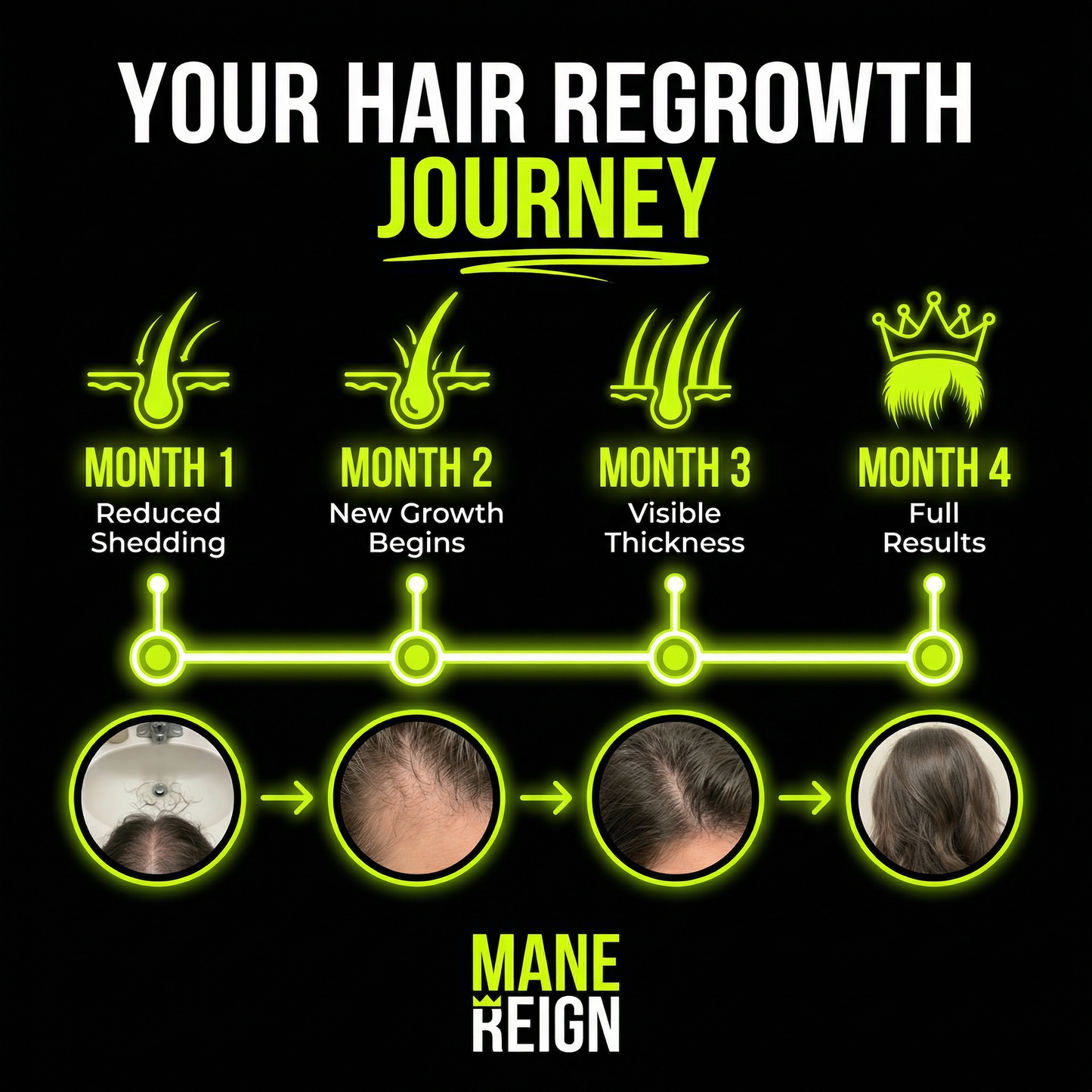 Mane Reign Hair growth serum