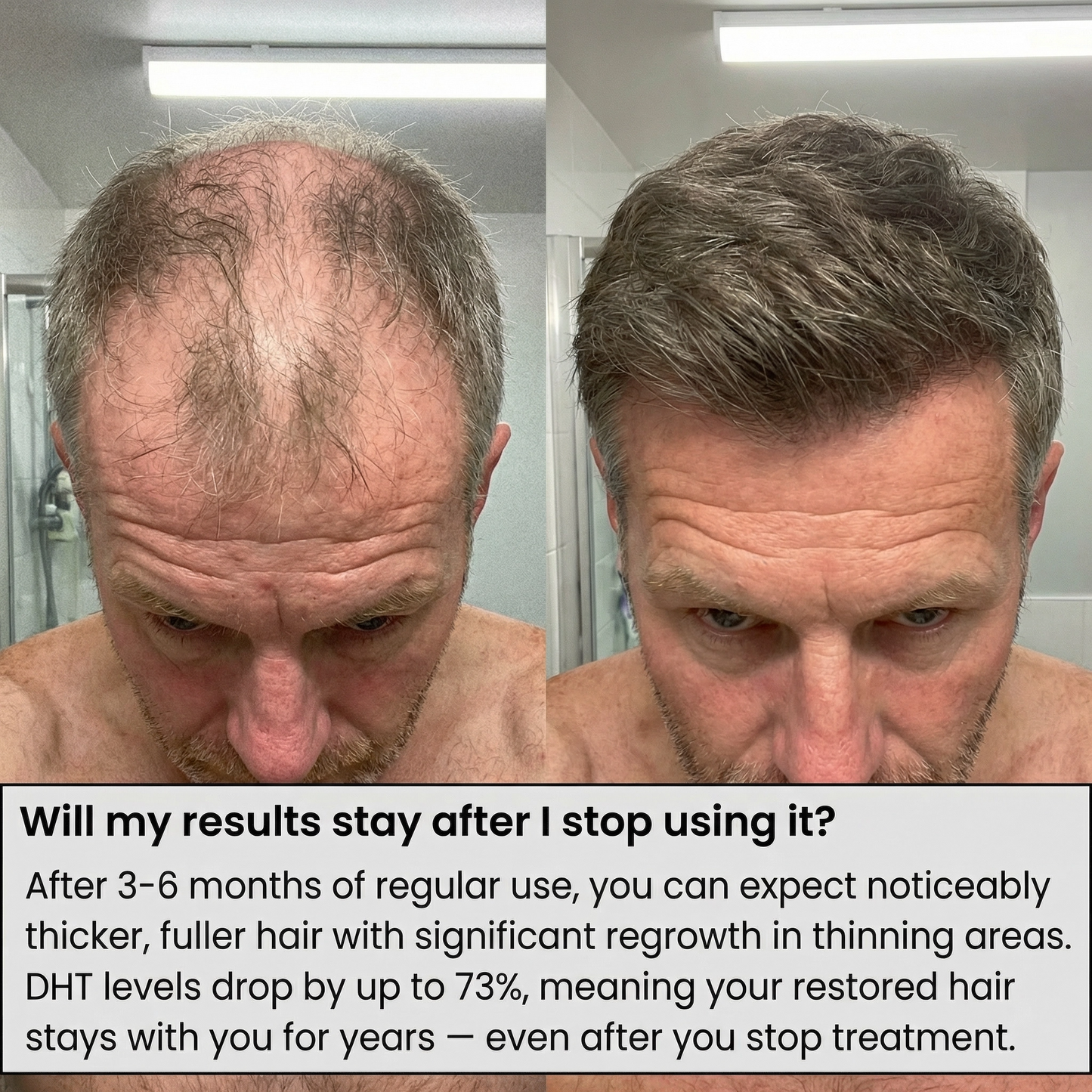 Mane Reign Hair growth serum