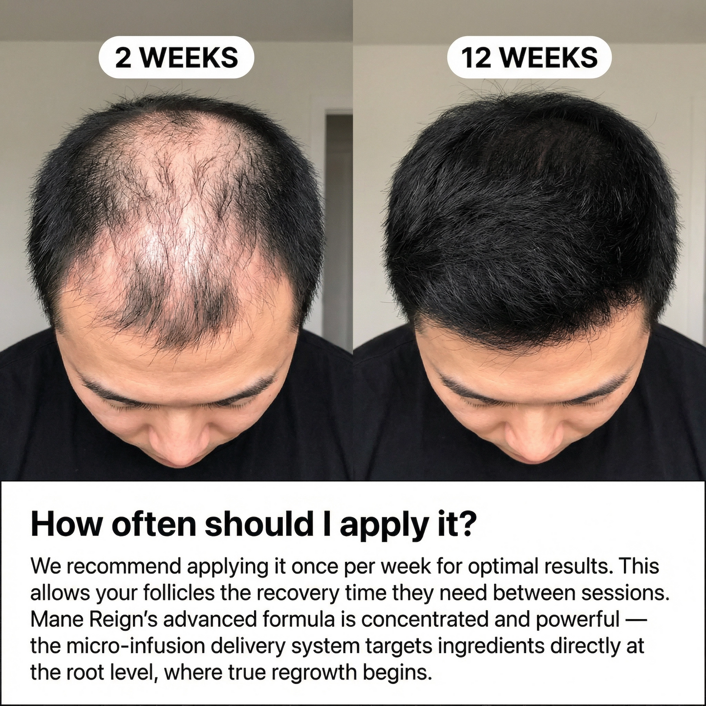 Mane Reign Hair growth serum